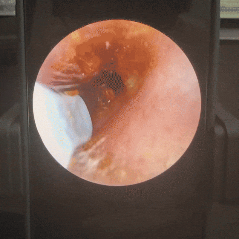 SalutePura™ VisioEar: tecnologia per la salute dell'orecchio approvata dai medici